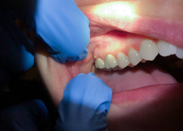 Best Knocked-Out Tooth Emergency  in Dublin, OH