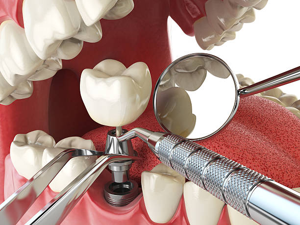 Best Emergency Gum Pain Relief  in Dublin, OH